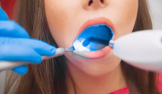 A dental professional uses a light and tools to examine a patient's mouth during a dental procedure.