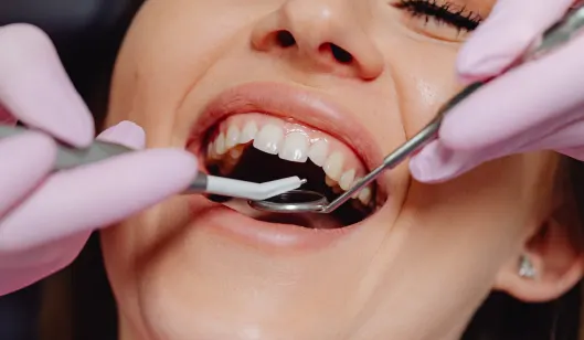 A dentist examining a patient's teeth with dental tools while the patient smiles in a treatment setting.