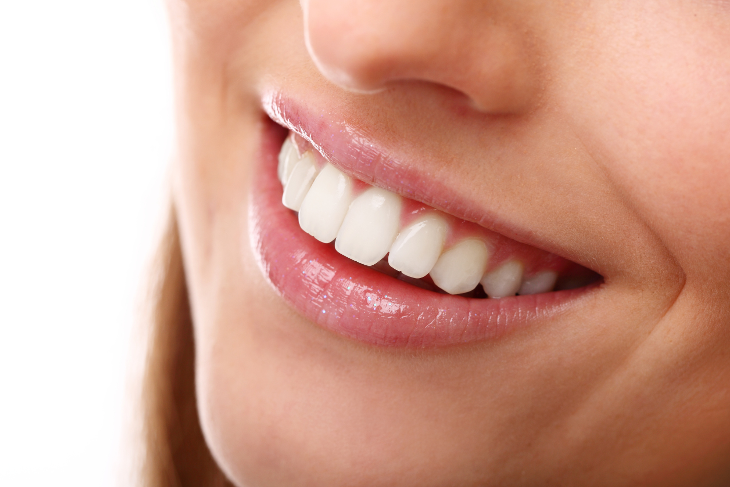 A close-up of a woman's smile, showcasing bright, white teeth and glossy lips.