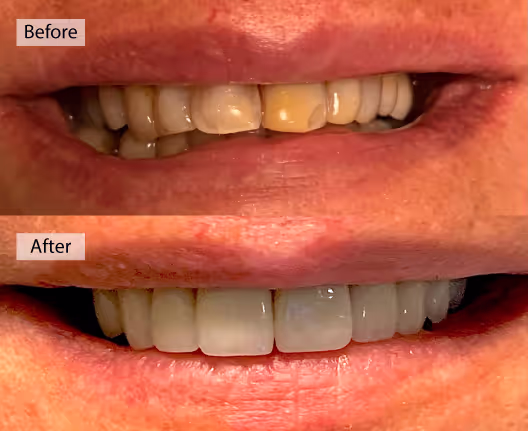 Dentist Renton WA