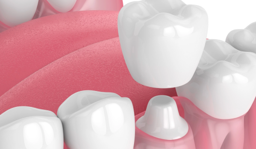 Close-up of white teeth and pink gums, illustrating dental anatomy relevant to dentistry services.