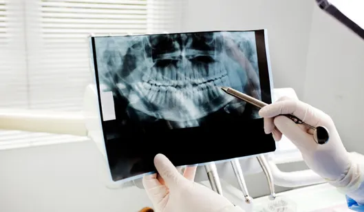 A dentist in gloves pointing to an X-ray image of teeth in a dental office.